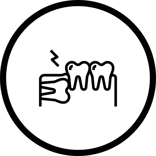kanal